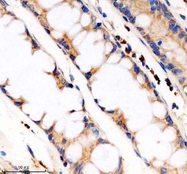 Anti-PDE4A Antibody Boster Bio