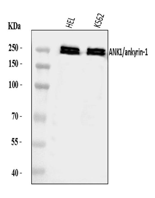 Anti-Ankyrin erythroid/ANK/ANK1 Antibody Picoband® Boster Bio