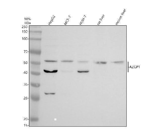 Anti-Zinc Alpha 2 Glycoprotein/AZGP1 Antibody Picoband® Boster Bio