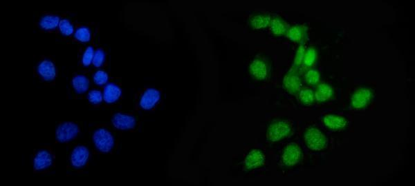 Anti-APRT Antibody Picoband® Boster Bio