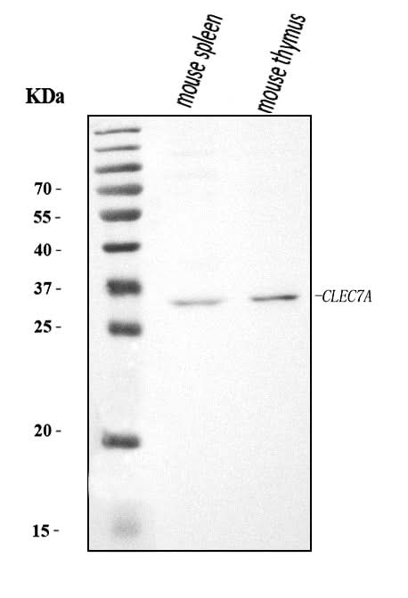 Anti-Dectin-1/Clec7a Antibody Picoband® Boster Bio