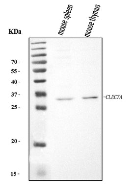 Anti-Dectin-1/Clec7a Antibody Picoband® Boster Bio