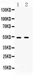 Anti-Muscarinic Acetylcholine Receptor 2/CHRM2 Antibody Picoband® Boster Bio