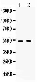 Anti-Muscarinic Acetylcholine Receptor 2/CHRM2 Antibody Picoband® Boster Bio