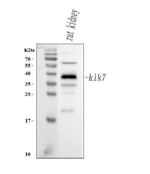 Anti-Klk7 Antibody Picoband® Boster Bio