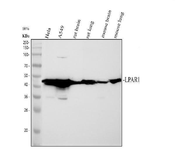 Anti-EDG2/LPAR1 Antibody Picoband® Boster Bio