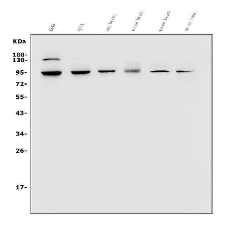 Anti-VRL1/TRPV2 Antibody Picoband® Boster Bio