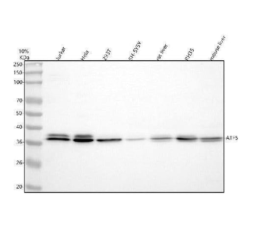 Anti-ATF5 Antibody Picoband® Boster Bio