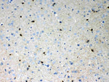 Anti-HCN2 Antibody Picoband® Boster Bio