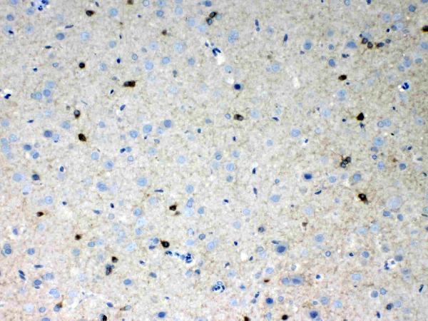Anti-HCN2 Antibody Picoband® Boster Bio