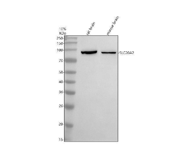 Anti-SLC20A2 Antibody Picoband® Boster Bio