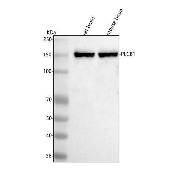 Anti-PLCB1 Antibody Picoband® Boster Bio