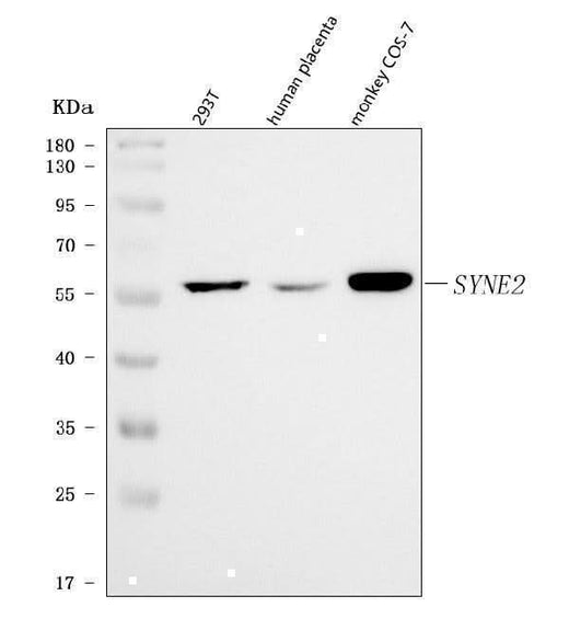 Anti-Nesprin 2/SYNE2 Antibody Picoband® Boster Bio