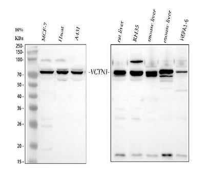 Anti-B7H4/VTCN1 Antibody Picoband® Boster Bio