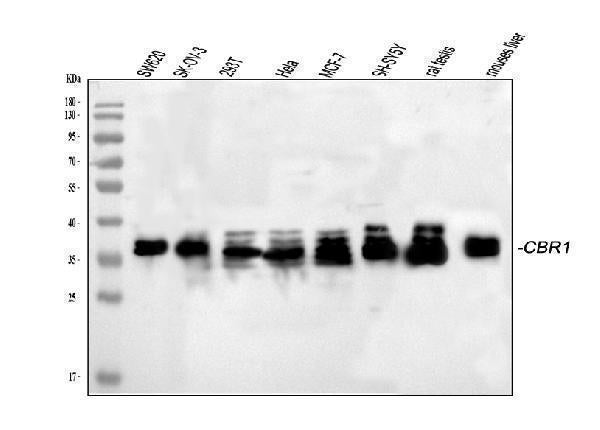 Anti-CBR1 Picoband® Antibody Boster Bio