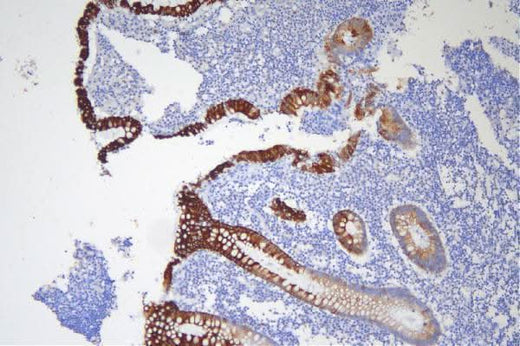 Anti-Cytokeratin 20/Krt20 Antibody Picoband® Boster Bio