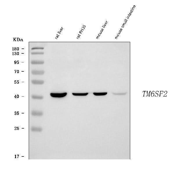 Anti-TM6SF2 Antibody Picoband® Boster Bio