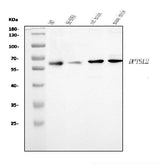 Anti-CRMP2/DPYSL2 Antibody Picoband® Boster Bio