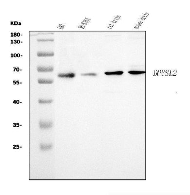 Anti-CRMP2/DPYSL2 Antibody Picoband® Boster Bio