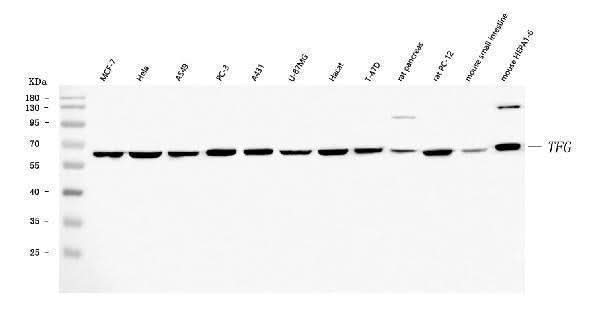 Anti-TRK fused gene/TFG Antibody Picoband® Boster Bio