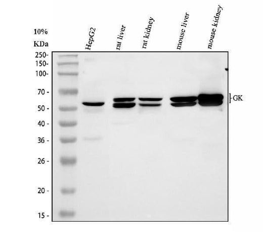 Anti-Glycerol kinase/GK Antibody Picoband® Boster Bio