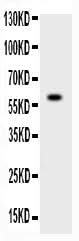 Anti-ADAMTS4/ADAMTS4 Antibody Picoband® Boster Bio