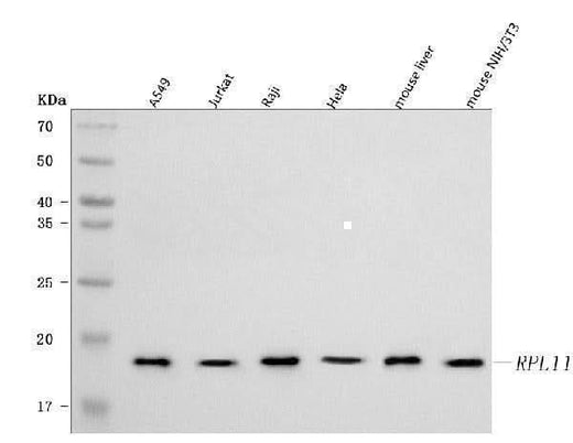 Anti-RPL11 Antibody Picoband® Boster Bio