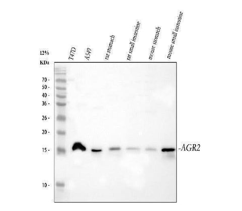 Anti-Anterior Gradient 2/AGR2 Antibody Picoband® Boster Bio