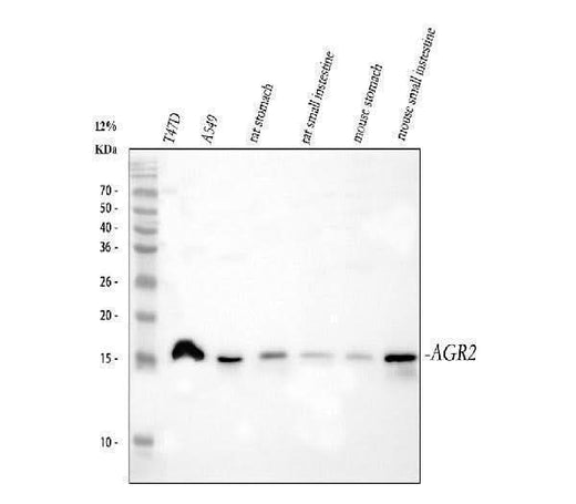 Anti-Anterior Gradient 2/AGR2 Antibody Picoband® Boster Bio