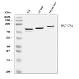 Anti-Hydroxysteroid (17-beta) Dehydrogenase 4/HSD17B4 Antibody Picoband® Boster Bio
