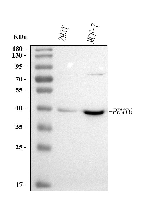 Anti-PRMT6 Antibody Picoband® Boster Bio