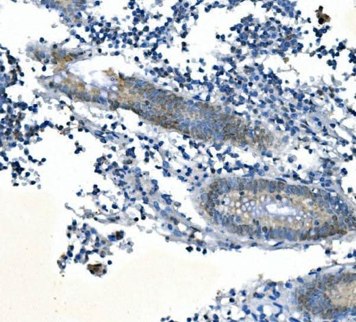 Anti-PPM1A Picoband® Antibody Boster Bio