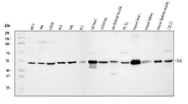 Anti-Integrin linked ILK Antibody Picoband® Boster Bio