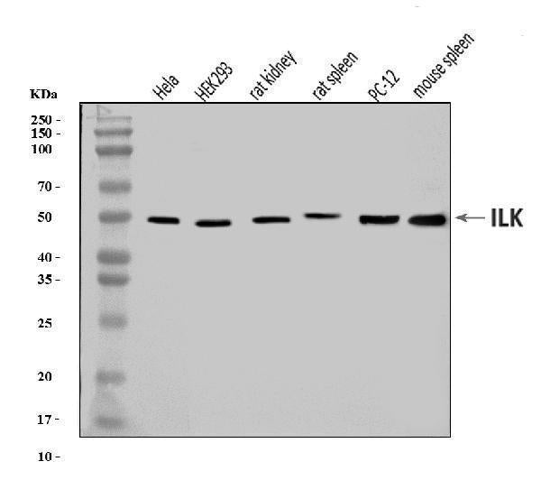 Anti-Integrin linked ILK Antibody Picoband® Boster Bio