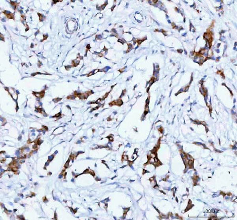 Anti-TACI/TNFRSF13B Antibody Boster Bio