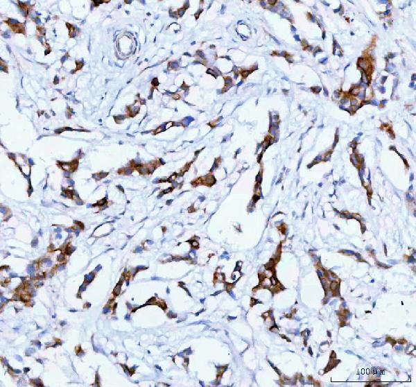 Anti-TACI/TNFRSF13B Antibody Boster Bio