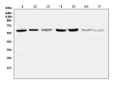Anti-TPA Tissue Plasminogen Activator/PLAT Antibody Picoband® Boster Bio