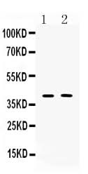 Anti-Islet 1/ISL1 Antibody Picoband® Boster Bio