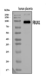 Anti-Fibulin 1/FBLN1 Antibody Picoband® Boster Bio