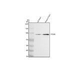 Anti-PYGM Antibody Picoband® Boster Bio