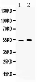 Anti-CDR2 Antibody Picoband® Boster Bio