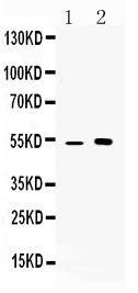 Anti-CDR2 Antibody Picoband® Boster Bio