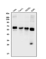 Anti-CDR2 Antibody Picoband® Boster Bio
