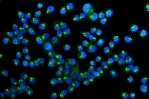Anti-Golm1/GOLPH2 Antibody Picoband® Boster Bio