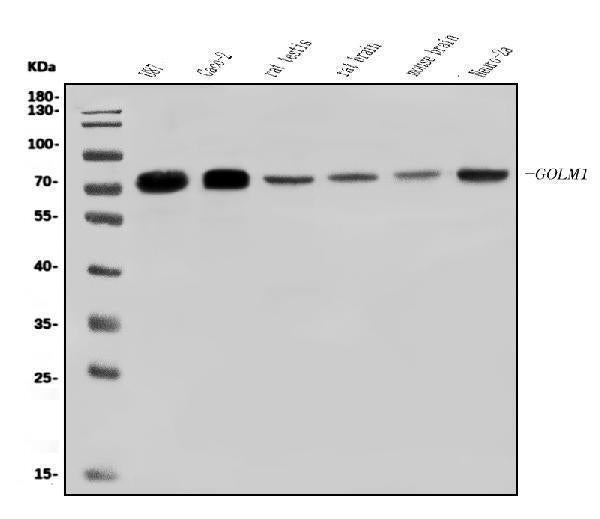 Anti-GOLPH2/GOLM1 Antibody Picoband® Boster Bio