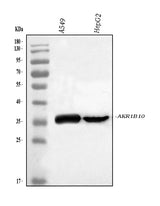 Anti-AKR1B10 Antibody Picoband® Boster Bio