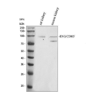Anti-CD105/Eng Antibody Picoband® Boster Bio