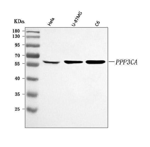 Anti-PPP3CA Antibody Picoband® Boster Bio