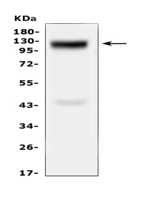 Anti-Collagen XVII/COL17A1 Antibody Picoband® Boster Bio