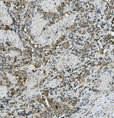 Anti-MRP5/ABCC5 Antibody Boster Bio